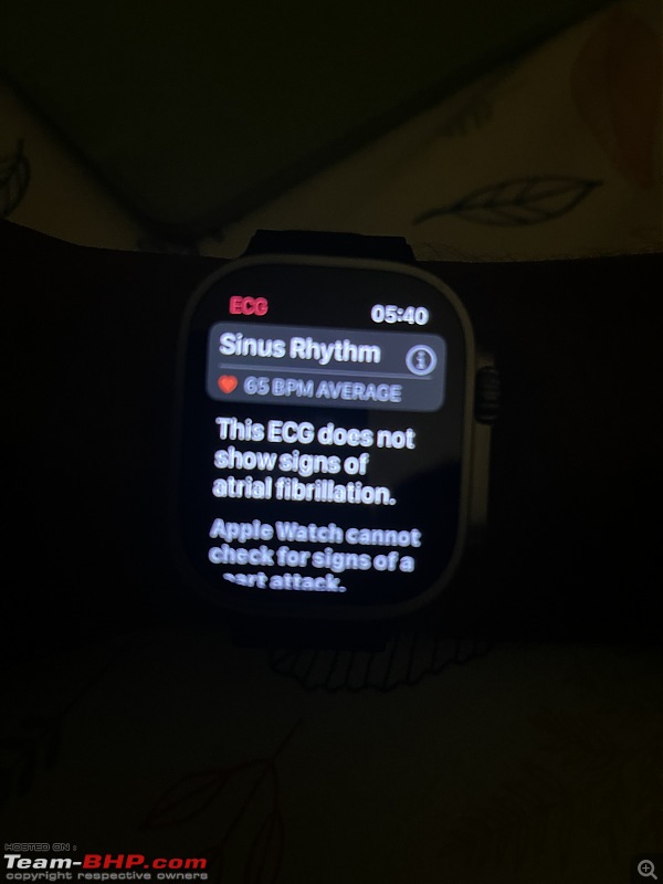 The quintessential Apple Watch thread-7e6a222de0e448b8b7be7ad9dff572ba.jpeg