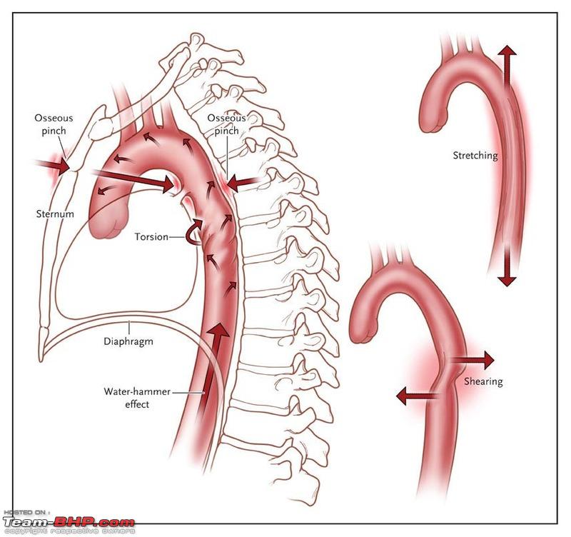 Name:  nejmra0706159_f1.jpeg
Views: 2183
Size:  99.4 KB